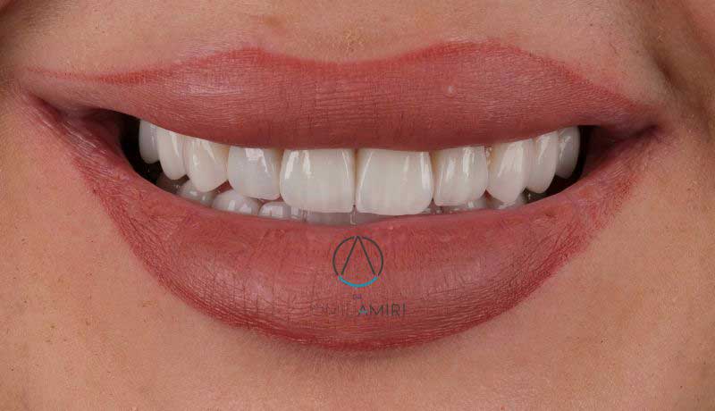 بهترین دندانپزشک متخصص طراحی لبخند در قم