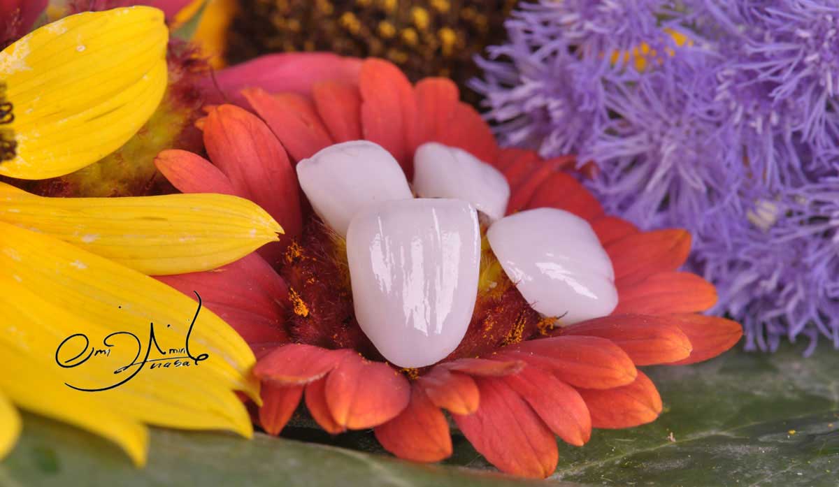 بهترین ایمپلنت قم بهترین ایمپلنت قم